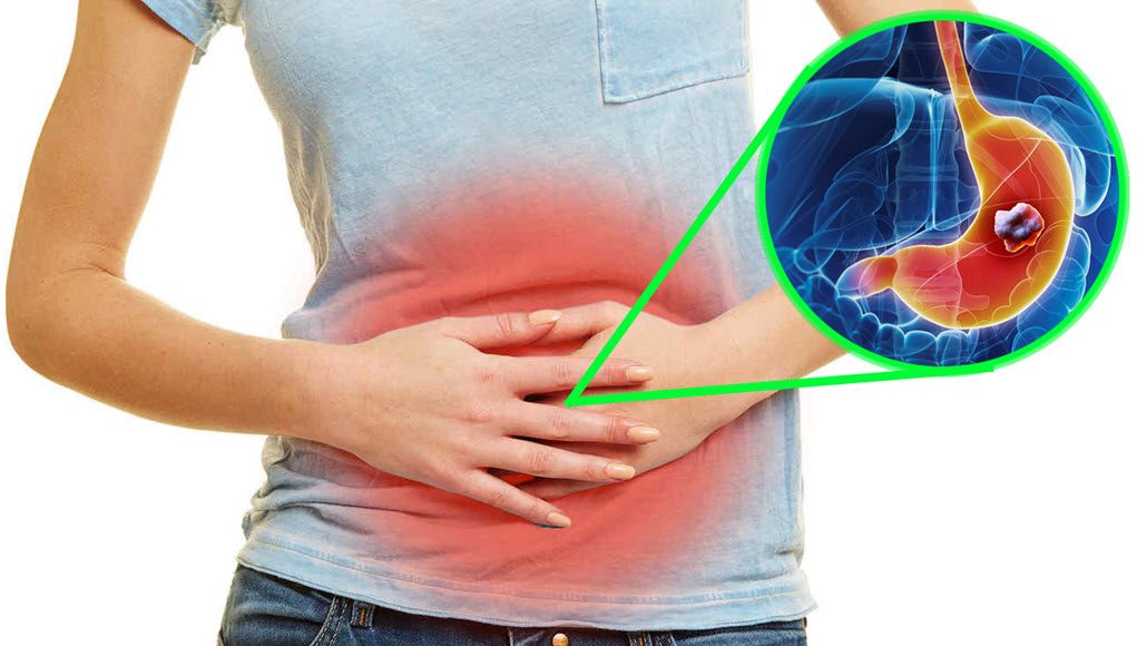 aliviar síntomas acidez